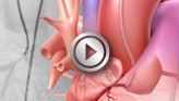 http://watchlearnlive.heart.org/images/
